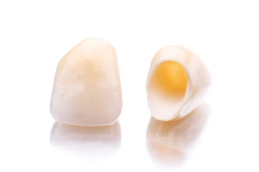 Two porcelain crowns photographed against a white background.